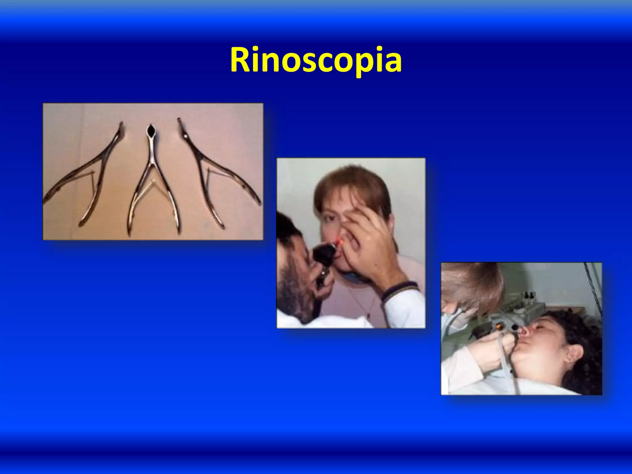 Rinoscopia