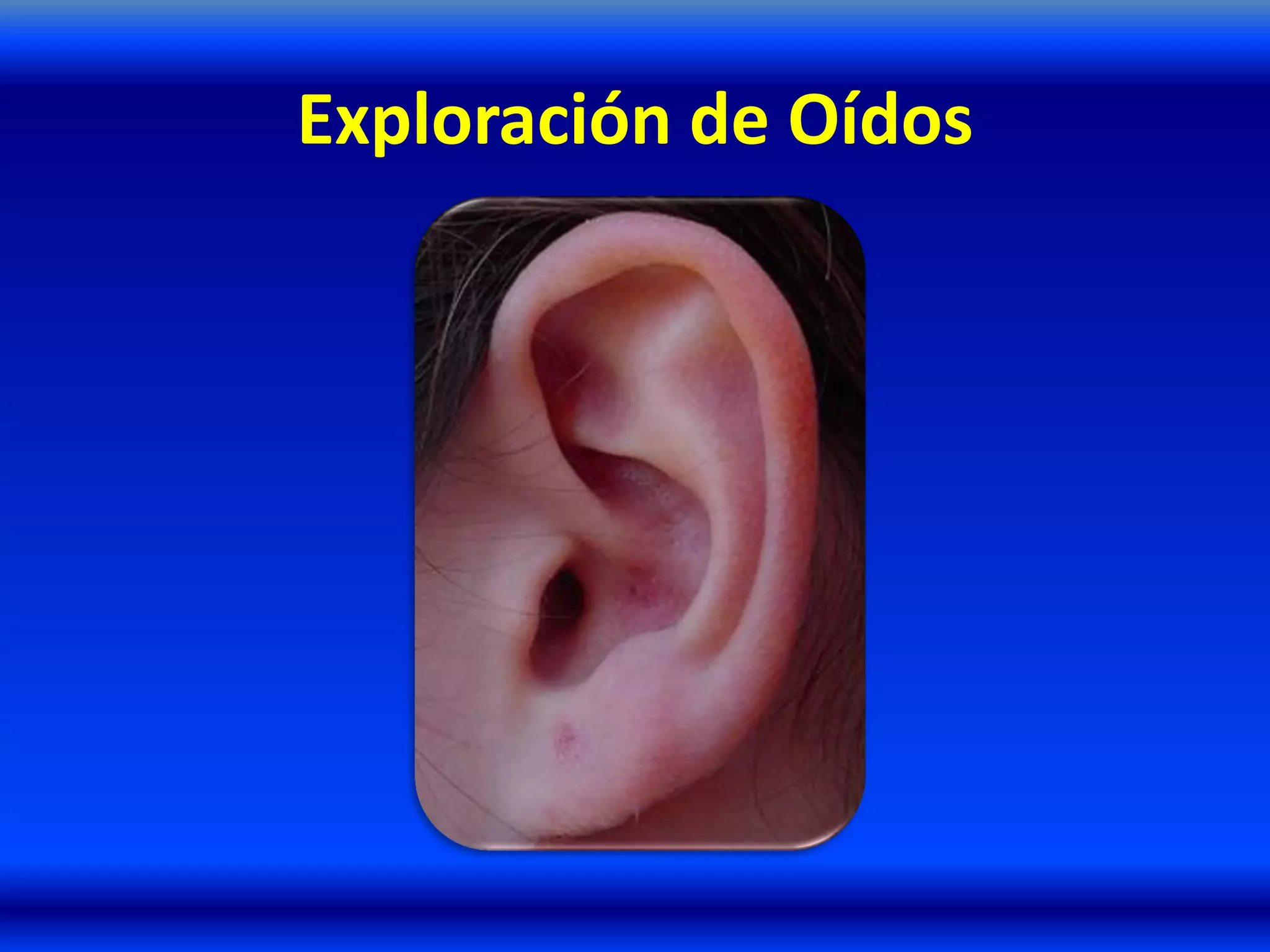 Exploración de Oídos