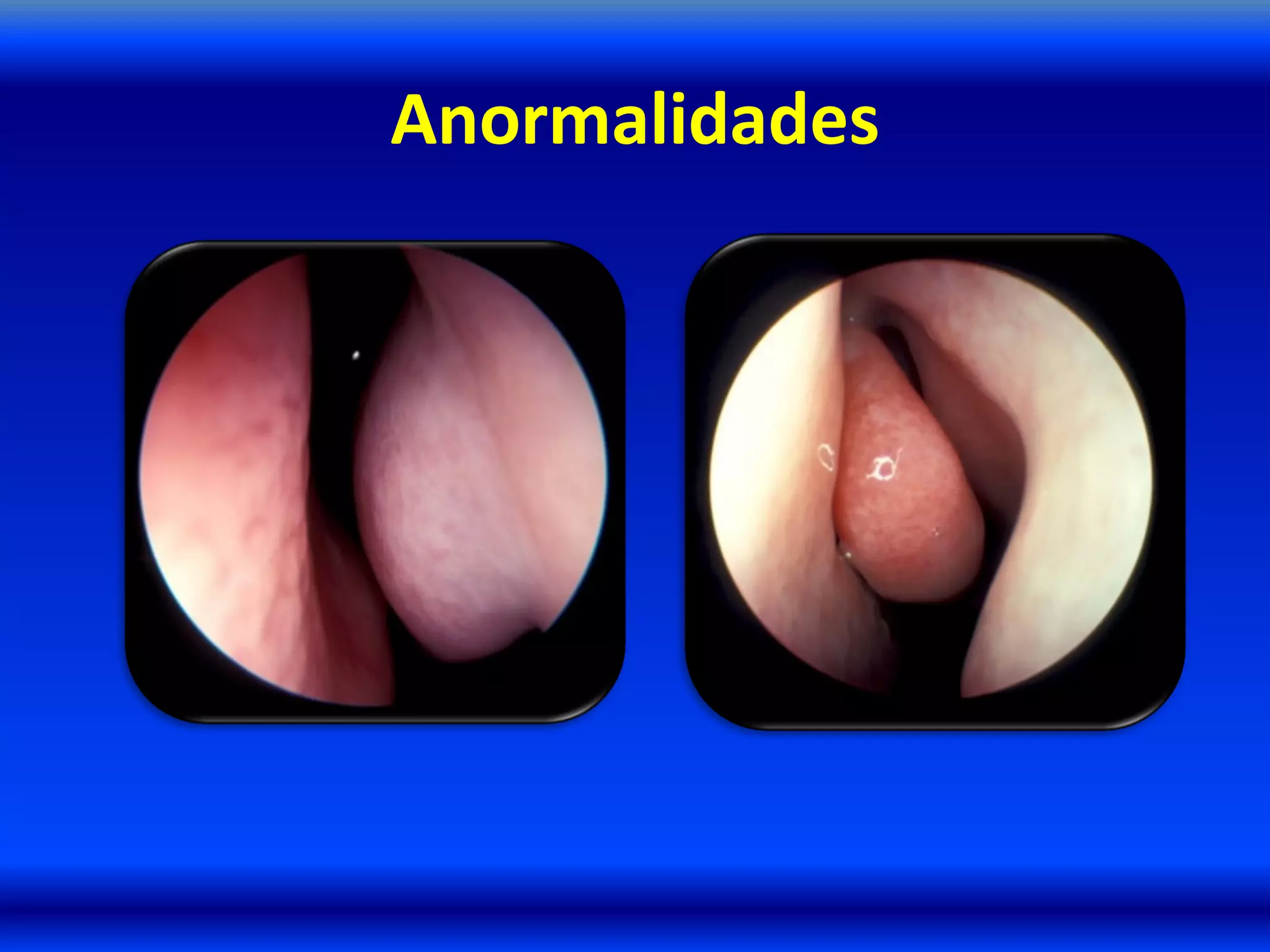 Anormalidades