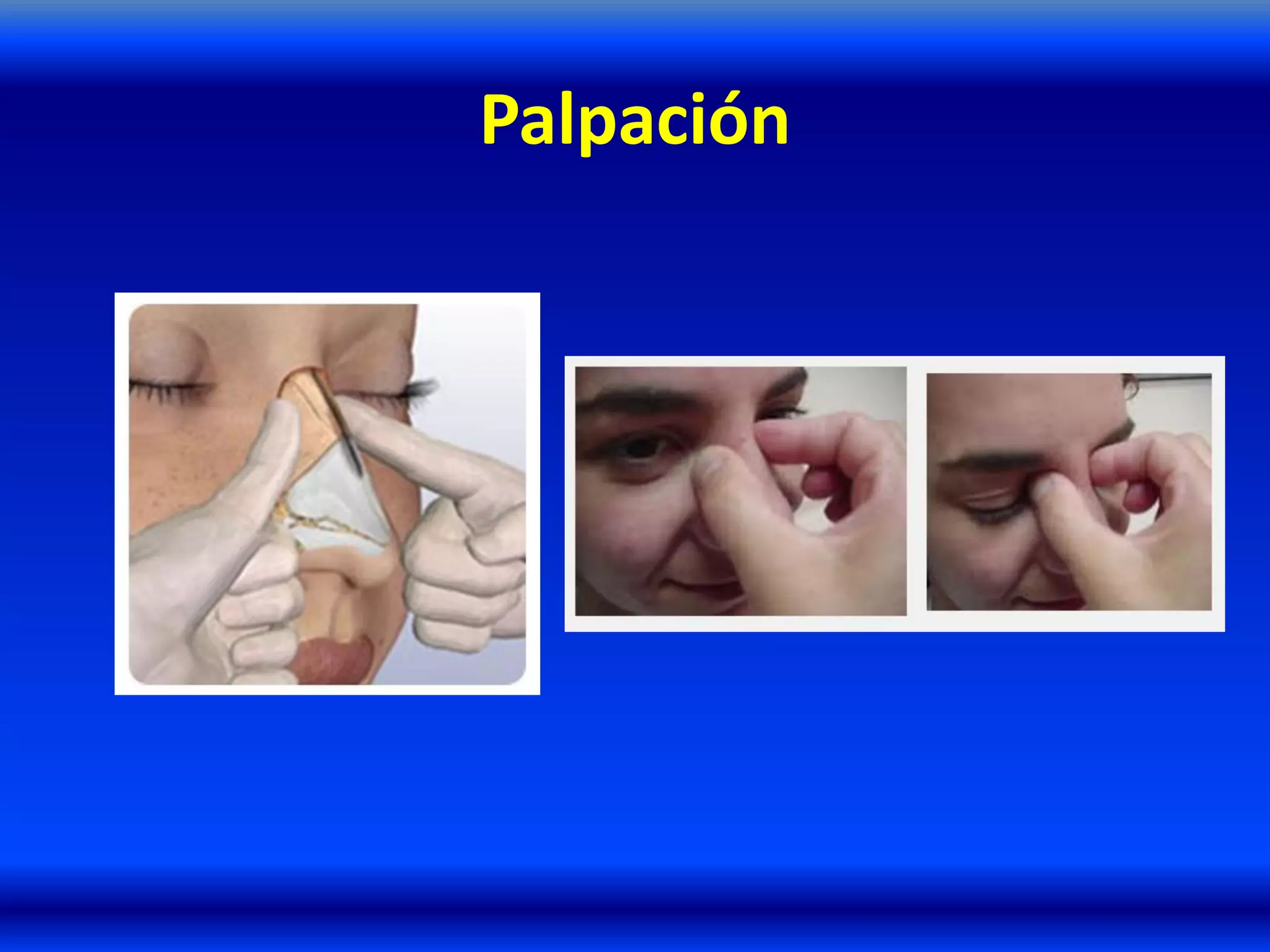 Palpación