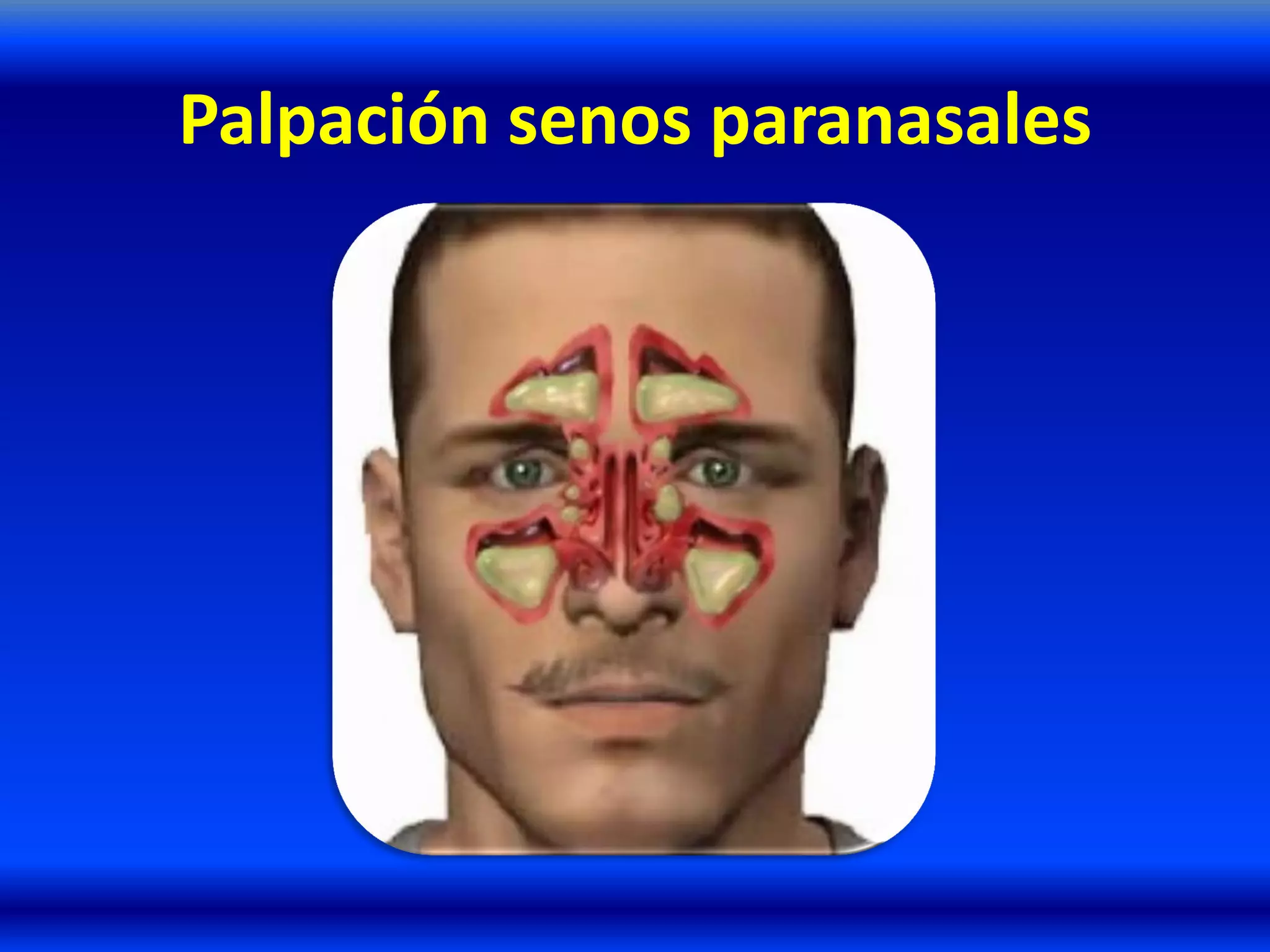 Palpación senos paranasales