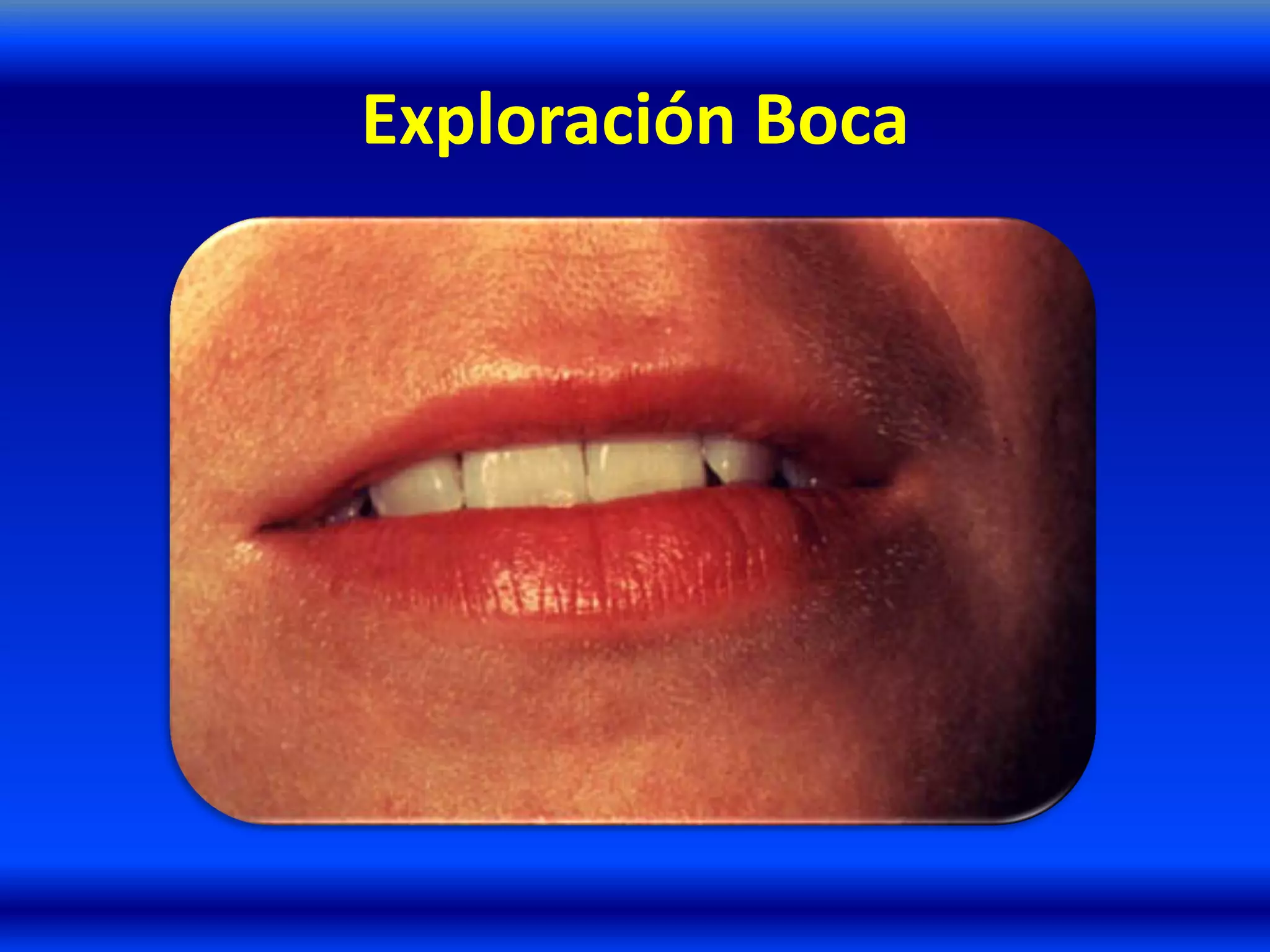 Exploración Boca