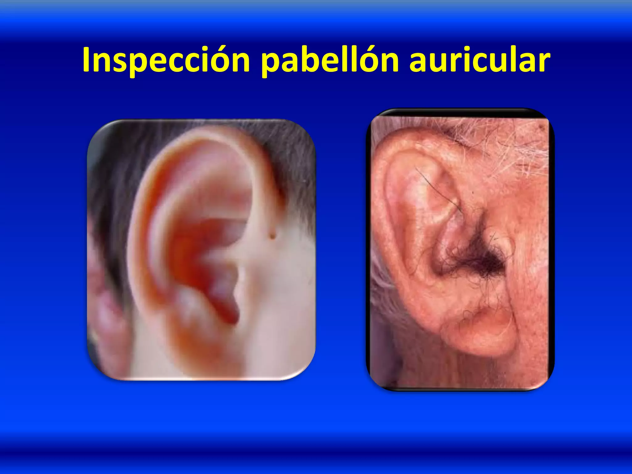 Inspección pabellón auricular
