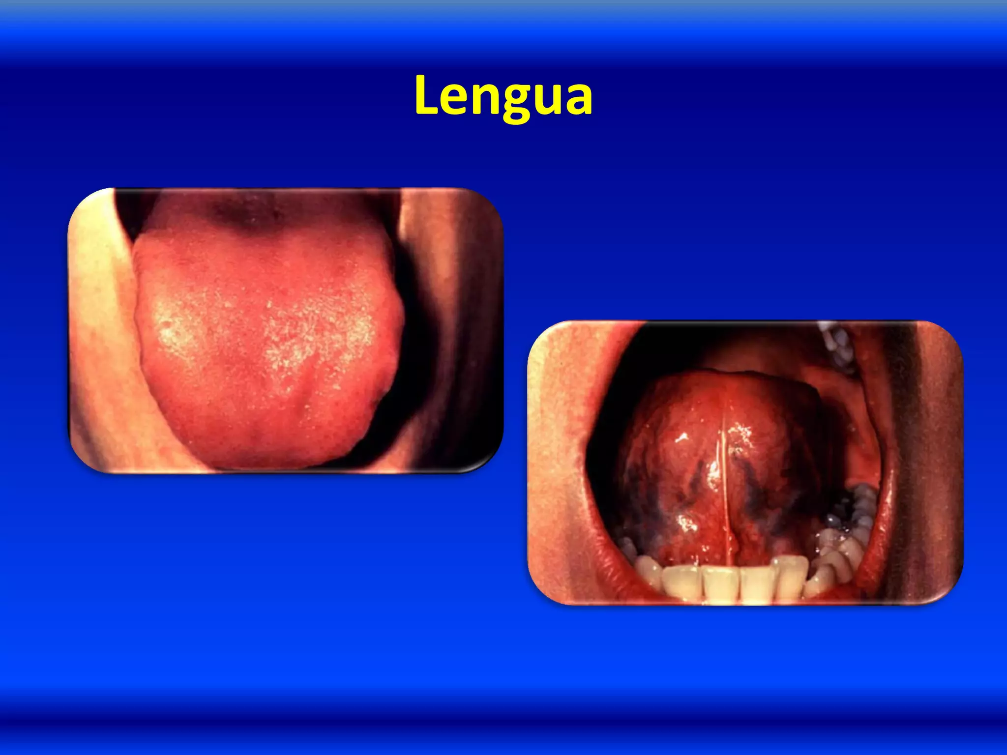 Lengua