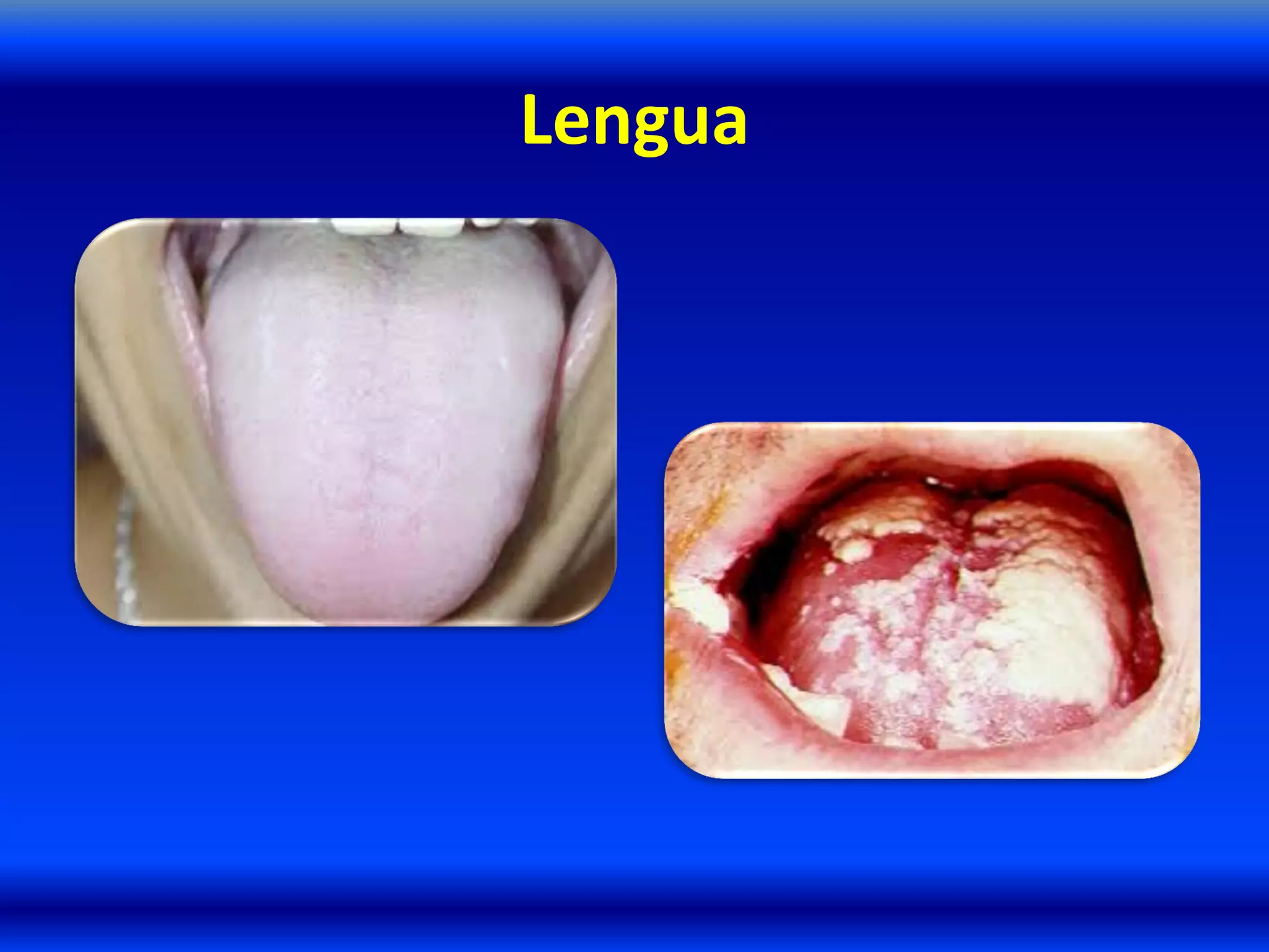 Lengua