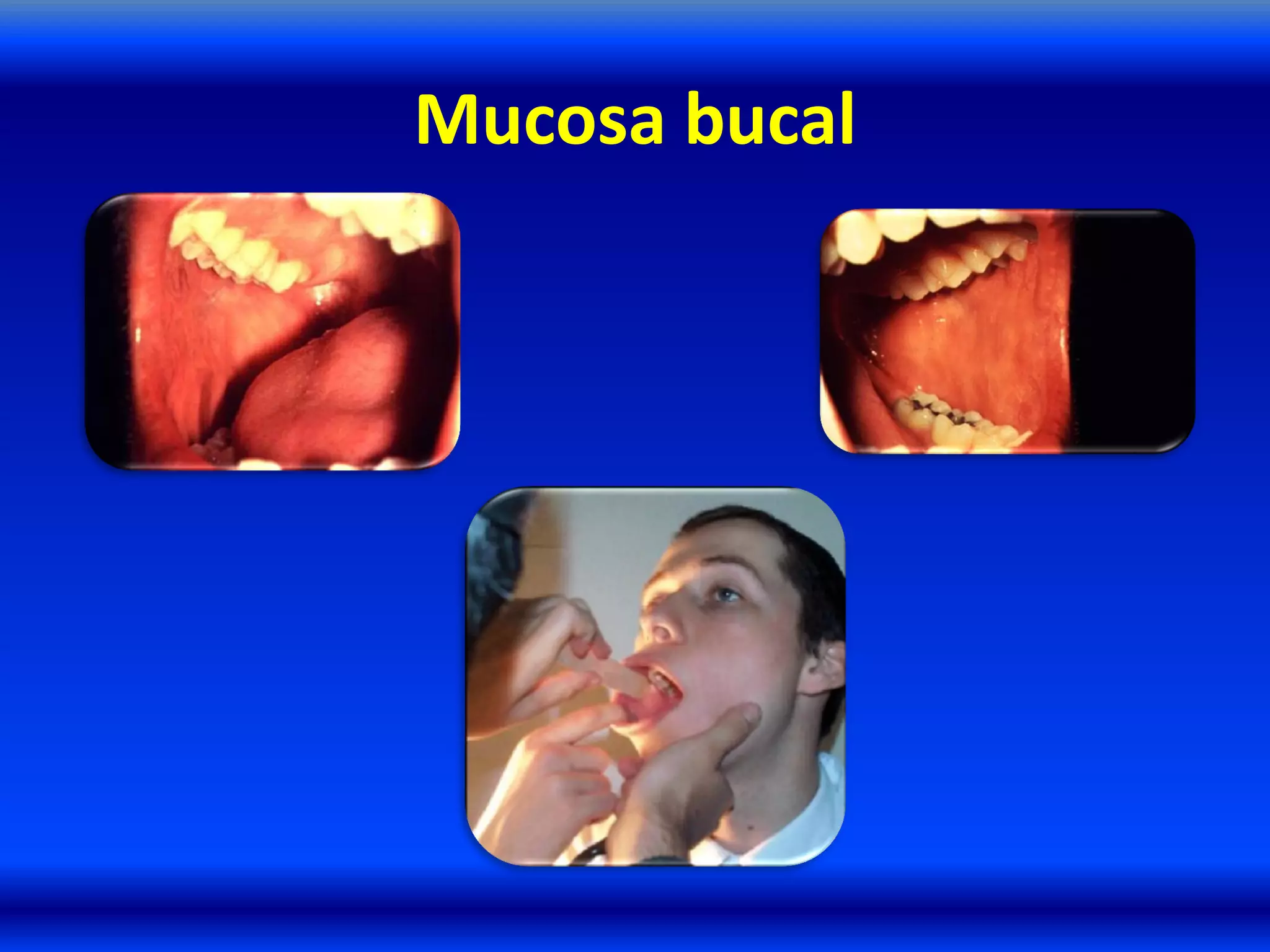 Mucosa bucal