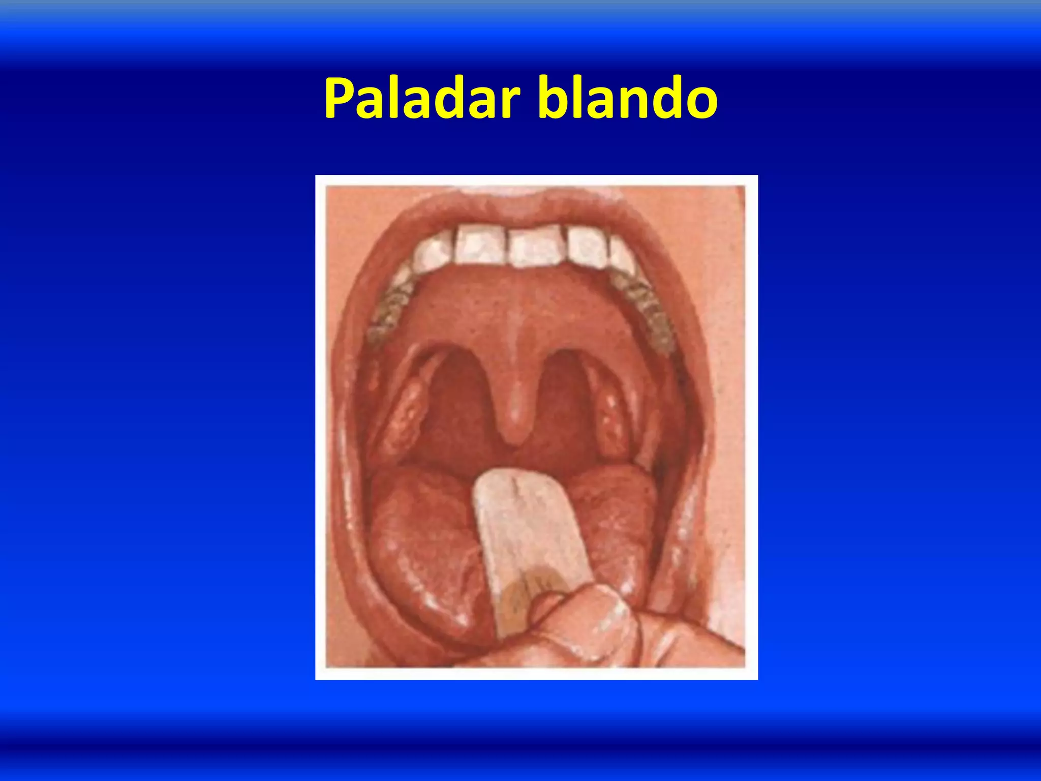 Paladar blando