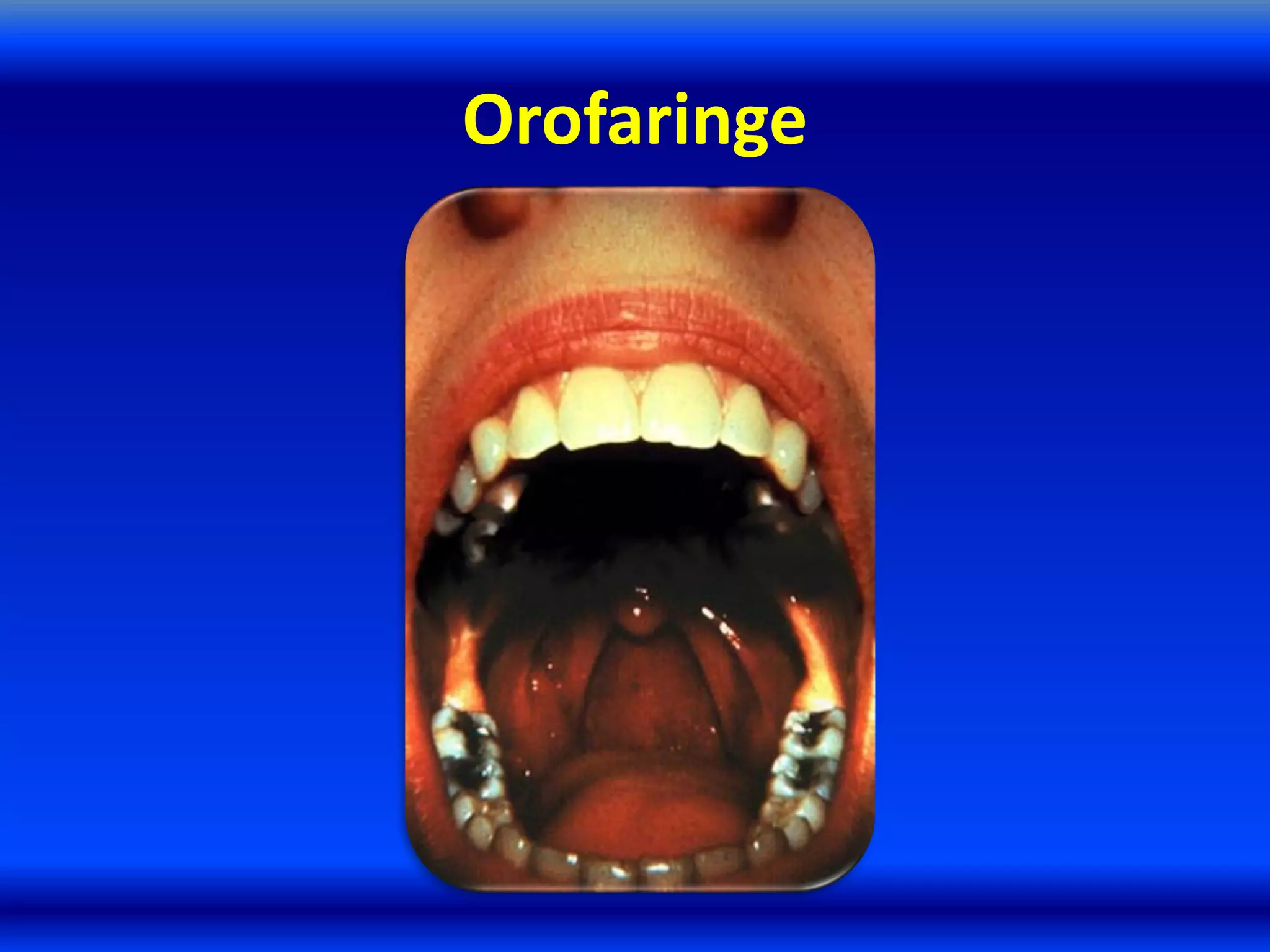 Orofaringe
