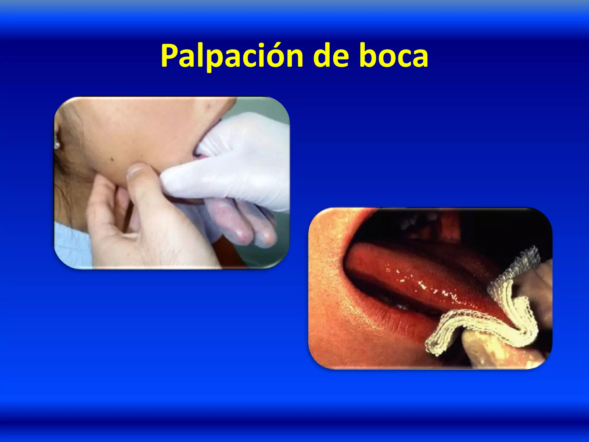 Palpación de boca