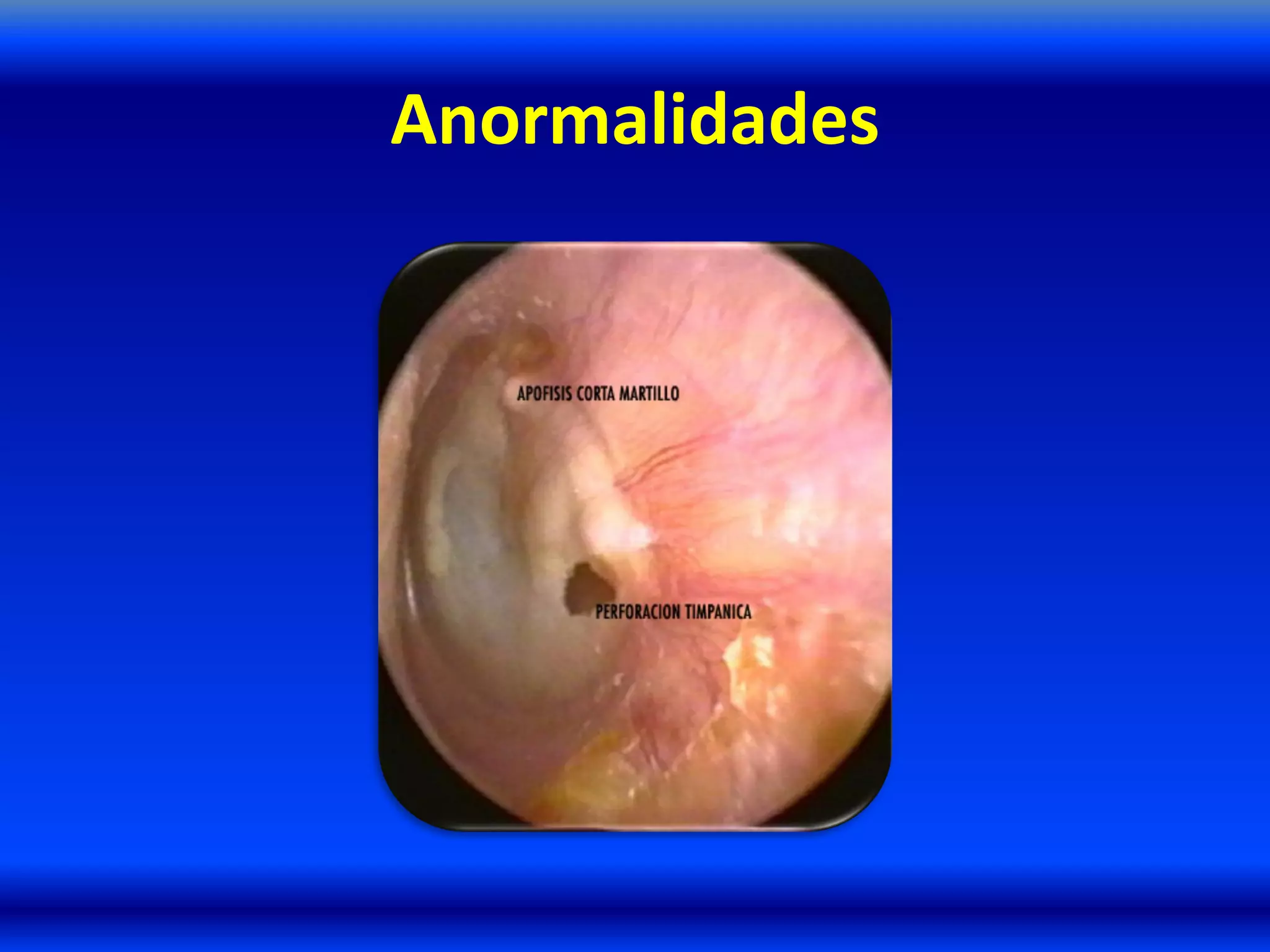 Anormalidades
