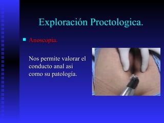 Exploración Proctologica.
   Anoscopia.

    Nos permite valorar el
    conducto anal asi
    como su patología.
 