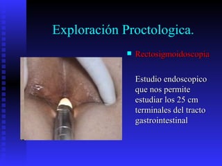 Exploración Proctologica.
                Rectosigmoidoscopia

                 Estudio endoscopico
                 que nos permite
                 estudiar los 25 cm
                 terminales del tracto
                 gastrointestinal
 