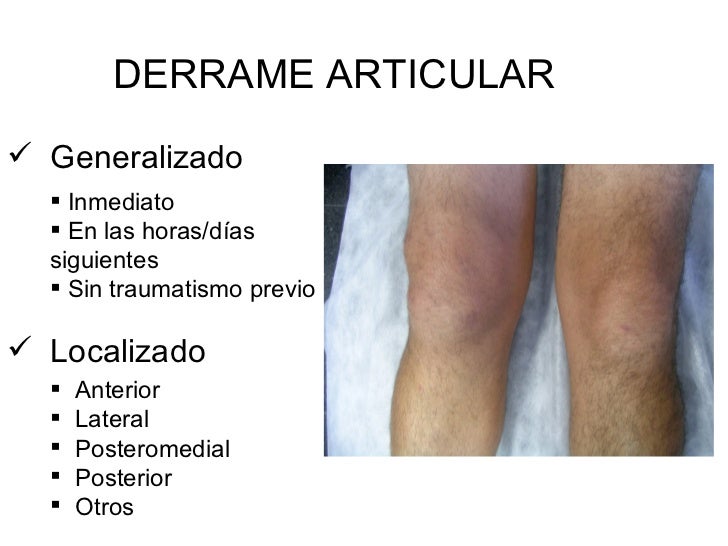 Exploraci n Rodilla versi n Reducida hospital Exploraci n Rodilla versi n Reducida hospital