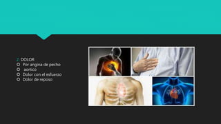 2. DOLOR
 Por angina de pecho
 aortico
 Dolor con el esfuerzo
 Dolor de reposo
 