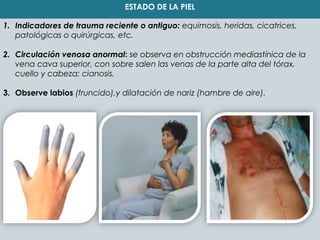 ESTADO DE LA PIEL 
1. Indicadores de trauma reciente o antiguo: equimosis, heridas, cicatrices, 
patológicas o quirúrgicas, etc. 
2. Circulación venosa anormal: se observa en obstrucción mediastínica de la 
vena cava superior, con sobre salen las venas de la parte alta del tórax, 
cuello y cabeza; cianosis. 
3. Observe labios (fruncido),y dilatación de nariz (hambre de aire). 
 