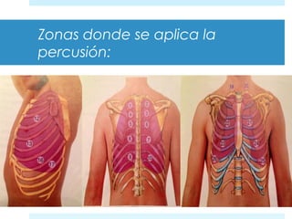 Zonas donde se aplica la 
percusión: 
 