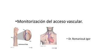 •Monitorización del acceso vascular.
• Dr. Romaniouk Igor
 