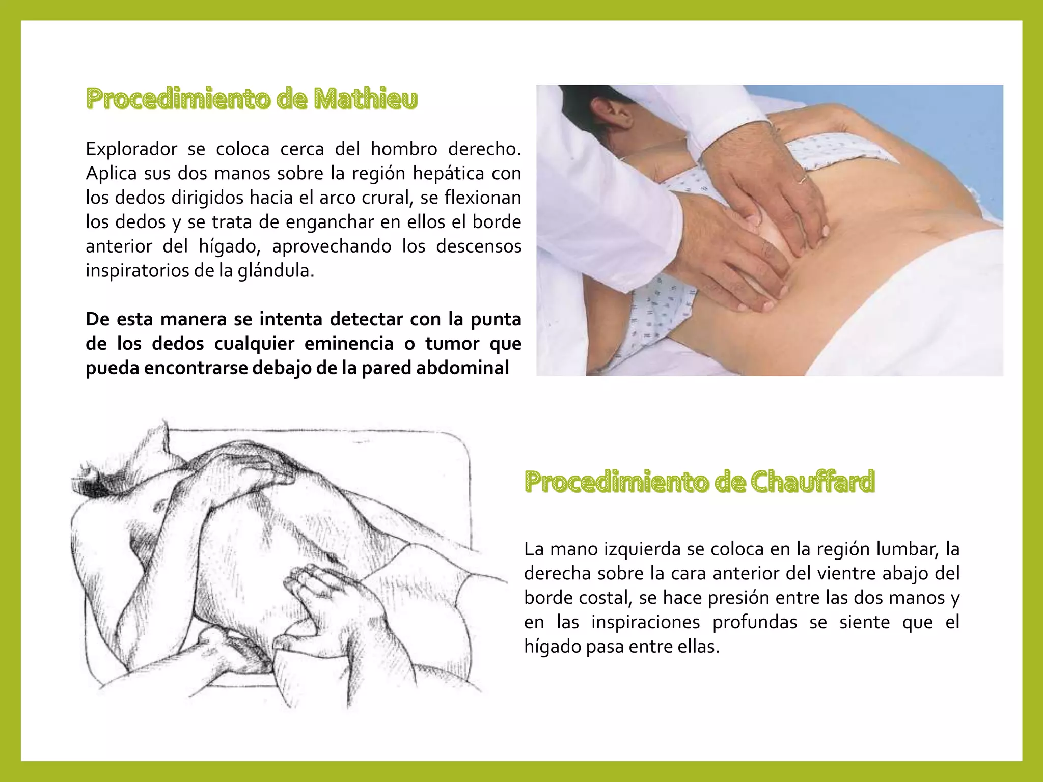 Exploracion de hígado propedeutica | PPTX
