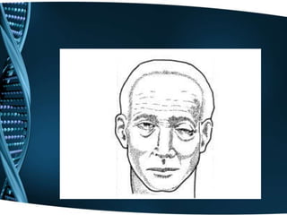 1. Motilidad extrínseca del ojo:	a) Abertura palpebral (III par).	b) Movimientos oculares.2. Motilidad intrínseca del ojo (III par):	a) Pupilas: forma y contorno, situación, tamaño, simetría, hippus pupilar.	b) Reflejo fotomotor.	c) Reflejo consensual.	d) Reflejo de la acomodación y convergencia.