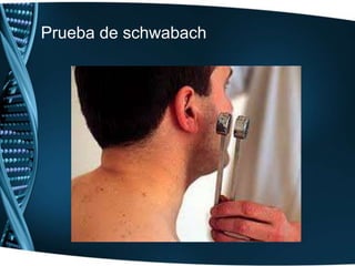 Prueba de rinne