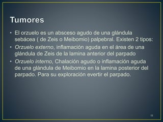 • El orzuelo es un absceso agudo de una glándula
sebácea ( de Zeis o Meibomio) palpebral. Existen 2 tipos:
• Orzuelo externo, inflamación aguda en el área de una
glándula de Zeis de la lamina anterior del parpado
• Orzuelo interno, Chalación agudo o inflamación aguda
de una glándula de Meibomio en la lamina posterior del
parpado. Para su exploración evertir el parpado.
11
 