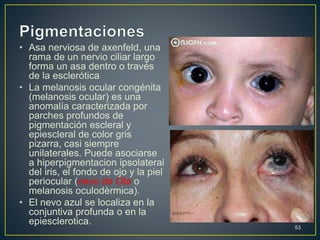 • Asa nerviosa de axenfeld, una
rama de un nervio ciliar largo
forma un asa dentro o través
de la esclerótica
• La melanosis ocular congénita
(melanosis ocular) es una
anomalía caracterizada por
parches profundos de
pigmentación escleral y
epiescleral de color gris
pizarra, casi siempre
unilaterales. Puede asociarse
a hiperpigmentacion ipsolateral
del iris, el fondo de ojo y la piel
periocular (nevo de Ota o
melanosis oculodèrmica).
• El nevo azul se localiza en la
conjuntiva profunda o en la
epiesclerotica.
53
 