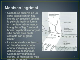 • Cuando se observa en un
corte sagital con un haz
fino de LH (sección óptica),
la película lagrimal forma
un menisco más o menos
triangular o “lago” entre el
borde palpebral inferior y el
sitio donde este borde
contacta con el globo
ocular
• La asuencia de menisco o
un tamaño menor de lo
normal indican que hay
deficiencia de lágrimas.
Cuando hay lagrimeo o
epifora, el menisco es mas 57
 