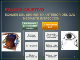 EXAMEN DEL SEGMENTO ANTERIOR DEL OJO
MEDIANTE INSPECCIÓN
59
Importante
para detectar
signos
Córnea y
Esclerótica
Iris y Cristalino
Cámara
anterior del ojo
Lo realizamos
con
Iluminación
oblicua o lateral
con linterna
Linterna y lupa
binocular frontal
Linterna y lupa
monocular
 