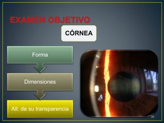 Alt. de su transparencia
Dimensiones
Forma
60
CÓRNEA
 