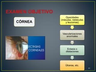 Opacidades
(máculas, nebéculas
y leucomas)
Vascularizaciones
anormales
Ectasia o
dilataciones
Úlceras, etc.
61
CÓRNEA
 