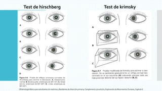 Hirschberg Test Normal Exploracion de Movimientos Oculares.pptx