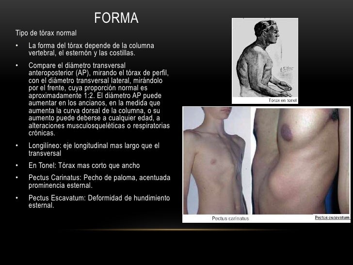 Los hinchazones después del aumento del pecho implantami