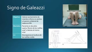 Objetivo Valorar acortamiento de
miembro inferior en adultos
y luxacion unilateral de
cadera en RN
Maniobra Paciente en decubito
supino, flexion de las rodillas
a 90º y talones al mismo
nivel
(+) Discrepancia en la altura de
las rodillas visible
 