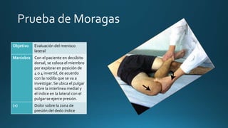 Objetivo Evaluación del menisco
lateral
Maniobra Con el paciente en decúbito
dorsal, se coloca el miembro
por explorar en posición de
4 o 4 invertid, de acuerdo
con la rodilla que se va a
investigar. Se ubica el pulgar
sobre la interlinea medial y
el índice en la lateral con el
pulgar se ejerce presión.
(+) Dolor sobre la zona de
presión del dedo índice
 