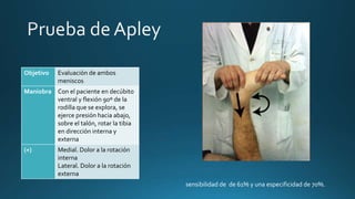 Objetivo Evaluación de ambos
meniscos
Maniobra Con el paciente en decúbito
ventral y flexión 90º de la
rodilla que se explora, se
ejerce presión hacia abajo,
sobre el talón, rotar la tibia
en dirección interna y
externa
(+) Medial. Dolor a la rotación
interna
Lateral. Dolor a la rotación
externa
sensibilidad de de 61% y una especificidad de 70%.
 