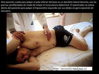 Otra posición usada para palpar el polo inferior del bazo es un decúbito lateral derecho, con las 
piernas semiflectadas de modo de relajar la musculatura abdominal. El examinador se coloca 
detrás del paciente para palpar el hipocondrio izquierdo con sus dedos en garra (posición de 
Schuster). 
posición de Schuster 
 