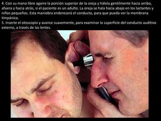 4. Con su mano libre agarre la porción superior de la oreja y hálela gentilmente hacia arriba, 
afuera y hacia atrás, si el paciente es un adulto. La oreja se hala hacia abajo en los lactantes y 
niños pequeños. Esta maniobra enderezará el conducto, para que pueda ver la membrana 
timpánica. 
5. Inserte el otoscopio y avance suavemente, para examinar la superficie del conducto auditivo 
externo, a través de las lentes. 
 