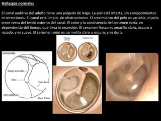Hallazgos normales 
El canal auditivo del adulto tiene una pulgada de largo. La piel está intacta, sin enrojecimientos 
ni secreciones. El canal está limpio, sin obstrucciones. El crecimiento del pelo es variable; el pelo 
crece cerca del tercio externo del canal. El color y la consistencia del cerumen varía, en 
dependencia del tiempo que lleva la secreción. El cerumen fresco es amarillo claro, oscuro o 
rosado, y es suave. El cerumen viejo es carmelita claro u oscuro, y es duro. 
 