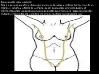 Brazos en alto sobre la cabeza: 
Pida a la persona que alce los brazos por encima de la cabeza y continúe la inspección de las 
mamas. El tamaño y la forma de las mamas deben permanecer simétricos durante el 
movimiento. Anote la posición exacta de algún pezón supernumerario (pezones congénitos 
múltiples, encontrados a lo largo de la línea mamaria, desde la axila hasta la ingle) 
 