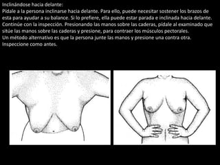 Inclinándose hacia delante: 
Pídale a la persona inclinarse hacia delante. Para ello, puede necesitar sostener los brazos de 
esta para ayudar a su balance. Si lo prefiere, ella puede estar parada e inclinada hacia delante. 
Continúe con la inspección. Presionando las manos sobre las caderas, pídale al examinado que 
sitúe las manos sobre las caderas y presione, para contraer los músculos pectorales. 
Un método alternativo es que la persona junte las manos y presione una contra otra. 
Inspeccione como antes. 
 