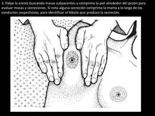 3. Palpe la areola buscando masas subyacentes y comprima la piel alrededor del pezón para 
evaluar masas y secreciones. Si nota alguna secreción comprima la mama a lo largo de los 
conductos sospechosos, para identificar el lóbulo que produce la secreción. 
 