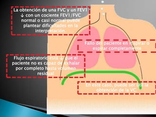 La obtención de una FVC y un FEV1
↓ con un cociente FEV1/FVC
normal o casi normal puede
plantear dificultades en la
interpretación.
Fallo del paciente en inspirar o
espirar completamente
Flujo espiratorio está ↓ que el
paciente no es capaz de exhalar
por completo hasta volumen
residual
En este caso, puede ser útil la
obtención de la VC.
 