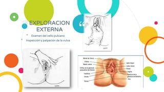 “
◎ EXPLORACION
EXTERNA
• Examen del vello pubiano
• Inspección y palpación de la vulva
6
 