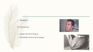 – Hipogloso
 Exploración:
o Inspección de la lengua.
o Movilidad y fuerza de la lengua.
 