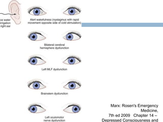 Marx: Rosen's Emergency Medicine, 7th ed 2009   Chapter 14 – Depressed Consciousness and Coma