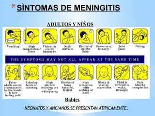 *SÌNTOMAS DE MENINGITIS
ADULTOS Y NIÑOS
Babies
NEONATOS Y ANCIANOS SE PRESENTAN ATIPICAMENTE.
 
