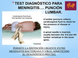 *TEST DIAGNÒSTICO PARA
MENINGITIS…. PUNCIÒN
LUMBAR.
A lumbar puncture collects
cerebrospinal fluid to check for
the presence of disease or
injury.
A spinal needle is inserted,
usually between the 3rd and 4th
lumbar vertebrae in the lower
spine.
PERMITE LA DISTINCIÒN URGENTE ENTRE
MENINGITIS BACTERIANA Y VIRAL ADMITIENDO
SU DIAGNÒSTICO PRECISO.
 