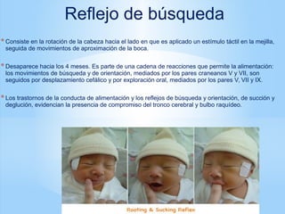 *Consiste en la rotación de la cabeza hacia el lado en que es aplicado un estímulo táctil en la mejilla,
seguida de movimientos de aproximación de la boca.
*Desaparece hacia los 4 meses. Es parte de una cadena de reacciones que permite la alimentación:
los movimientos de búsqueda y de orientación, mediados por los pares craneanos V y VII, son
seguidos por desplazamiento cefálico y por exploración oral, mediados por los pares V, VII y IX.
*Los trastornos de la conducta de alimentación y los reflejos de búsqueda y orientación, de succión y
deglución, evidencian la presencia de compromiso del tronco cerebral y bulbo raquídeo.
Reflejo de búsqueda
 