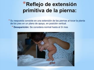*Reflejo de extensión
primitiva de la pierna:
*Su respuesta consiste en una extensión de las piernas al tocar la planta
de los pies en un plano de apoyo, en posición vertical.
*Desaparición: Se considera normal hasta el 3r mes
 