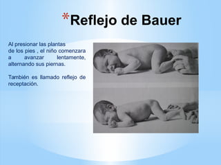 *Reflejo de Bauer
Al presionar las plantas
de los pies , el niño comenzara
a avanzar lentamente,
alternando sus piernas.
También es llamado reflejo de
receptación.
 